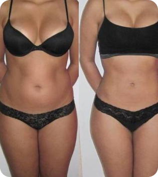 The result of using Lipoketonic our customer